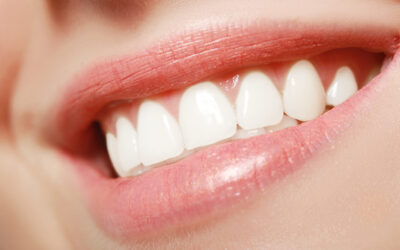 Preventative Dentistry: Importance of Regular Checkups (Scale and Clean)